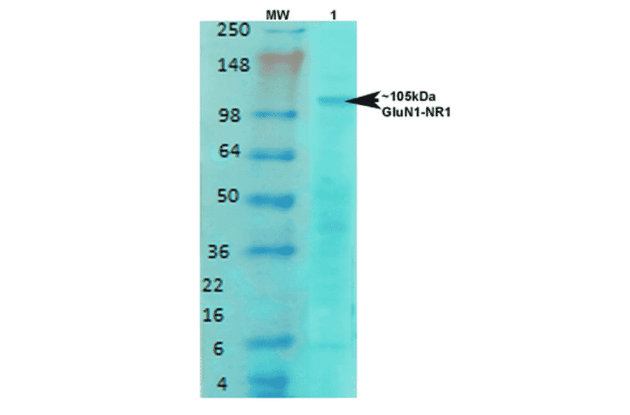 Western Blot - Anti-NMDAR1 Antibody [S308-48] (A304953) - Antibodies.com
