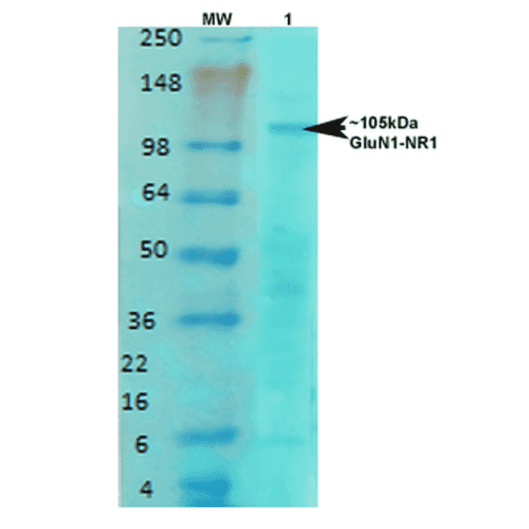 Western Blot - Anti-NMDAR1 Antibody [S308-48] (A304953) - Antibodies.com