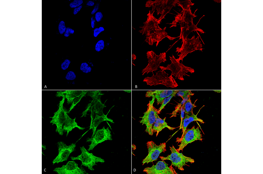 Immunocytochemistry/Immunofluorescence - Anti-NMDAR1 Antibody [S308-48] (A304953) - Antibodies.com