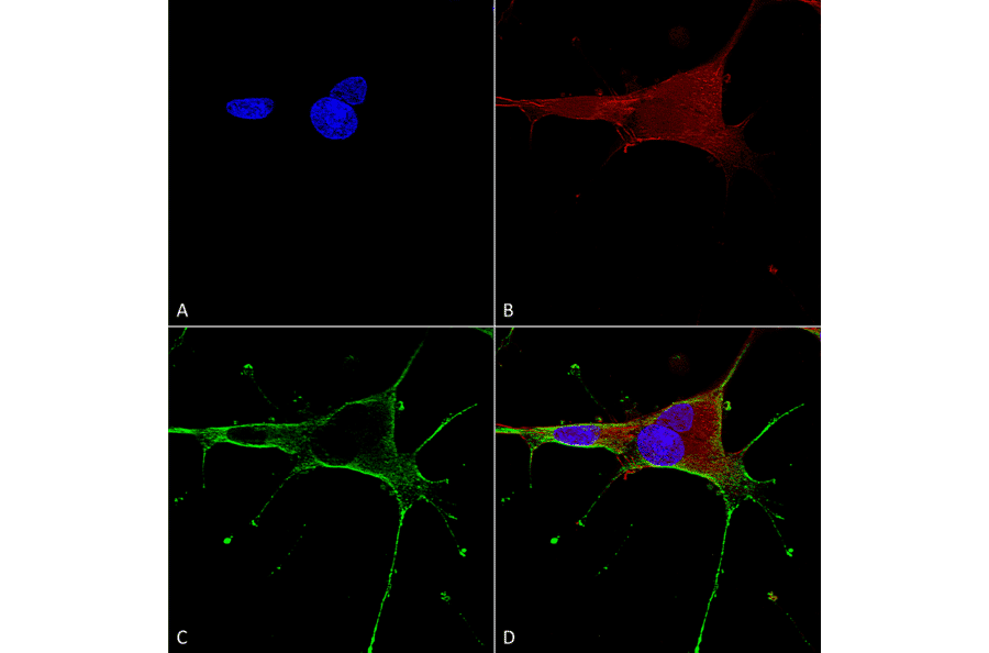 Immunocytochemistry/Immunofluorescence - Anti-NMDAR1 Antibody [S308-48] (A304953) - Antibodies.com