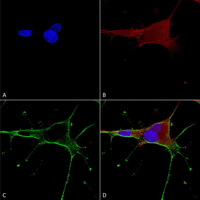 Immunocytochemistry/Immunofluorescence - Anti-NMDAR1 Antibody [S308-48] (A304953) - Antibodies.com