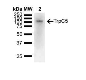 Western Blot - Anti-TRPC5 Antibody [N67/15] (A304954) - Antibodies.com