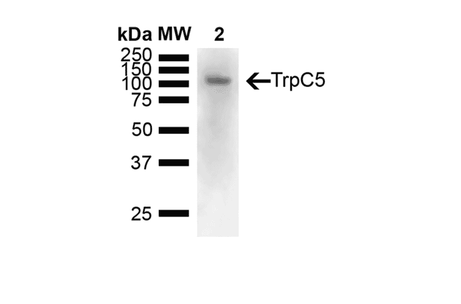 Western Blot - Anti-TRPC5 Antibody [N67/15] (A304954) - Antibodies.com