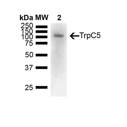 Western Blot - Anti-TRPC5 Antibody [N67/15] (A304954) - Antibodies.com