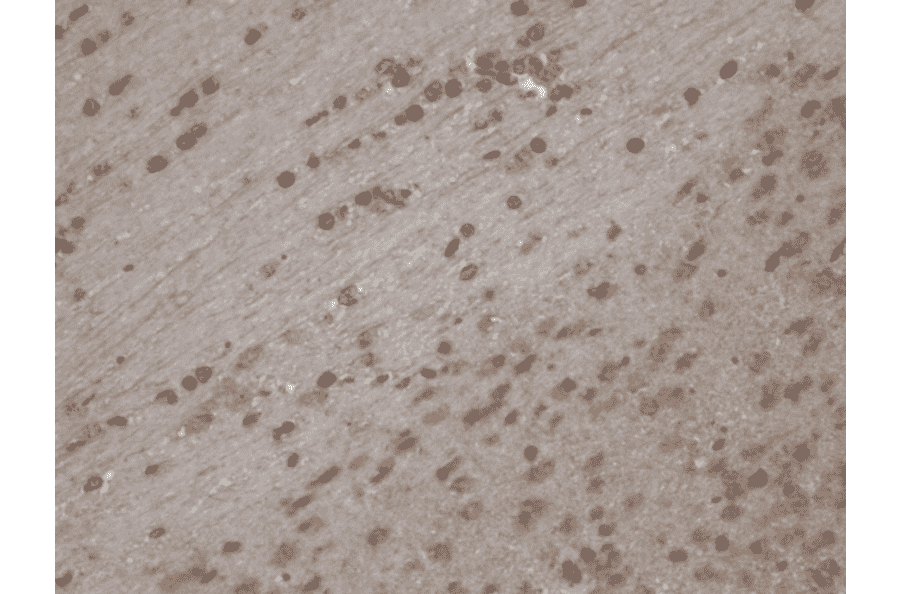 Immunohistochemistry - Anti-TRPC5 Antibody [N67/15] (A304954) - Antibodies.com