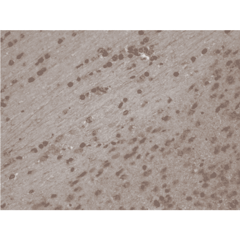 Immunohistochemistry - Anti-TRPC5 Antibody [N67/15] (A304954) - Antibodies.com