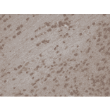 Immunohistochemistry - Anti-TRPC5 Antibody [N67/15] (A304954) - Antibodies.com