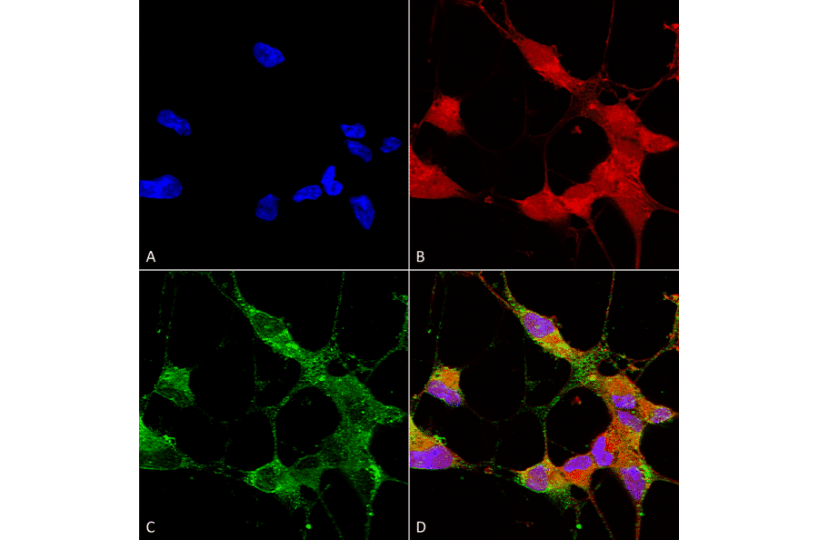 Immunocytochemistry/Immunofluorescence - Anti-TRPC5 Antibody [N67/15] (A304954) - Antibodies.com