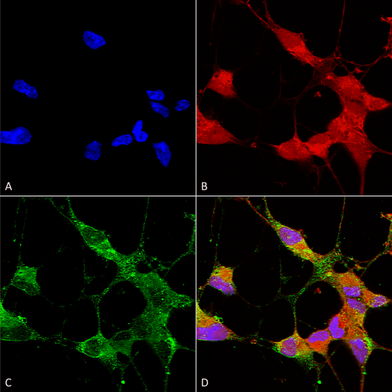 Immunocytochemistry/Immunofluorescence - Anti-TRPC5 Antibody [N67/15] (A304954) - Antibodies.com