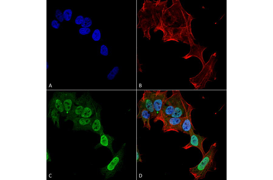 Immunocytochemistry/Immunofluorescence - Anti-mGluR5 Antibody [S75-33] (A304956) - Antibodies.com