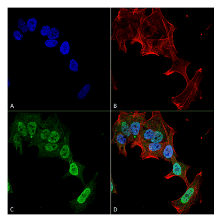 Immunocytochemistry/Immunofluorescence - Anti-mGluR5 Antibody [S75-33] (A304956) - Antibodies.com