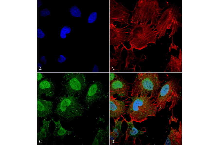 Immunocytochemistry/Immunofluorescence - Anti-mGluR5 Antibody [S75-3] (A304957) - Antibodies.com
