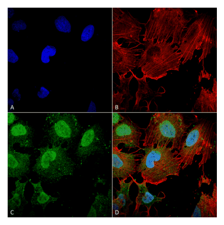 Immunocytochemistry/Immunofluorescence - Anti-mGluR5 Antibody [S75-3] (A304957) - Antibodies.com