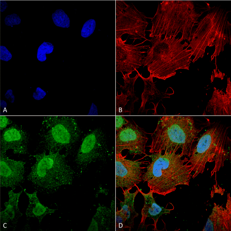 Immunocytochemistry/Immunofluorescence - Anti-mGluR5 Antibody [S75-3] (A304957) - Antibodies.com