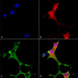 Immunocytochemistry/Immunofluorescence - Anti-mGluR5 Antibody [S75-3] (A304957) - Antibodies.com