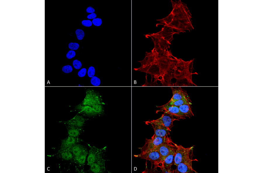 Immunocytochemistry/Immunofluorescence - Anti-LC3A Antibody (A304958) - Antibodies.com