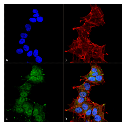 Immunocytochemistry/Immunofluorescence - Anti-LC3A Antibody (A304958) - Antibodies.com