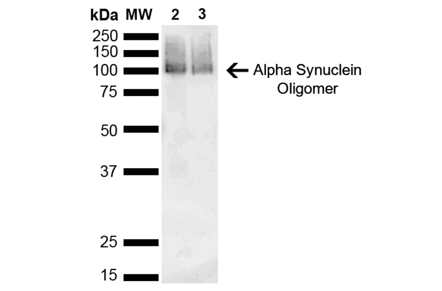 Western Blot - Anti-alpha Synuclein Antibody [3C11] (A304959) - Antibodies.com