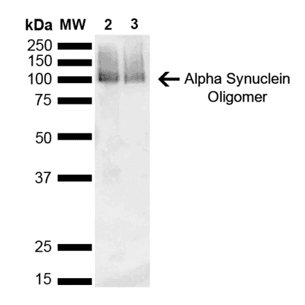 Western Blot - Anti-alpha Synuclein Antibody [3C11] (A304959) - Antibodies.com