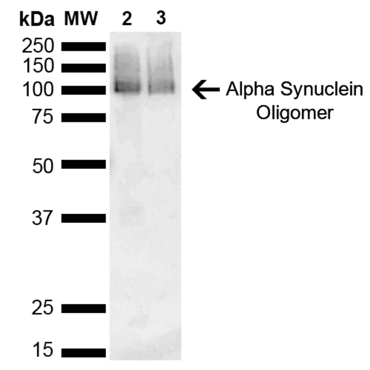 Western Blot - Anti-alpha Synuclein Antibody [3C11] (A304959) - Antibodies.com