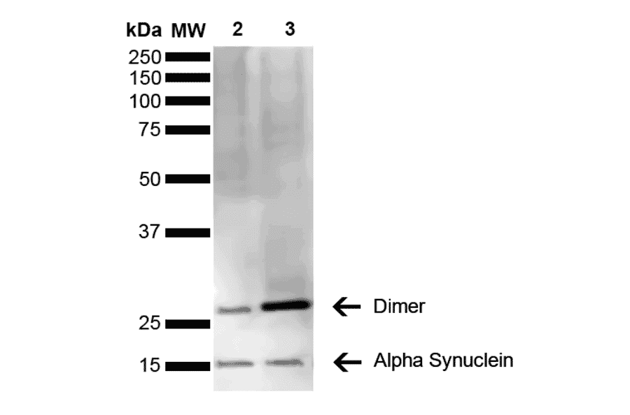 Western Blot - Anti-alpha Synuclein Antibody [3C11] (A304959) - Antibodies.com