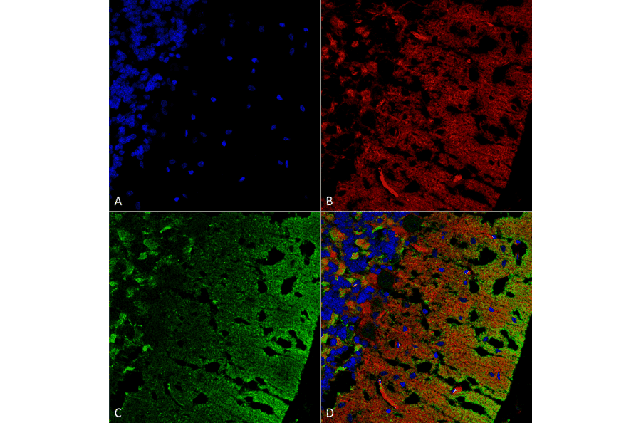 Immunohistochemistry - Anti-alpha Synuclein Antibody [3C11] (A304959) - Antibodies.com