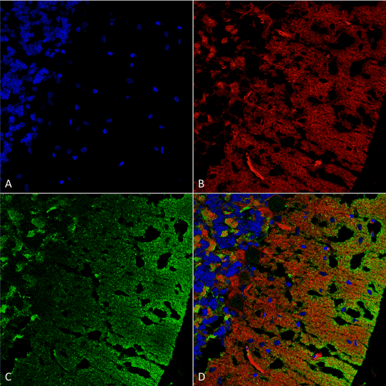 Immunohistochemistry - Anti-alpha Synuclein Antibody [3C11] (A304959) - Antibodies.com