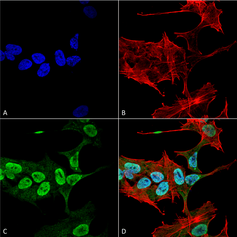 Immunocytochemistry/Immunofluorescence - Anti-alpha Synuclein Antibody [3C11] (A304959) - Antibodies.com