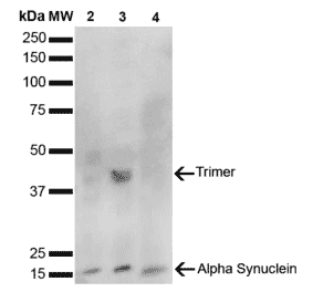 Western Blot - Anti-alpha Synuclein Antibody [10H7] (A304960) - Antibodies.com