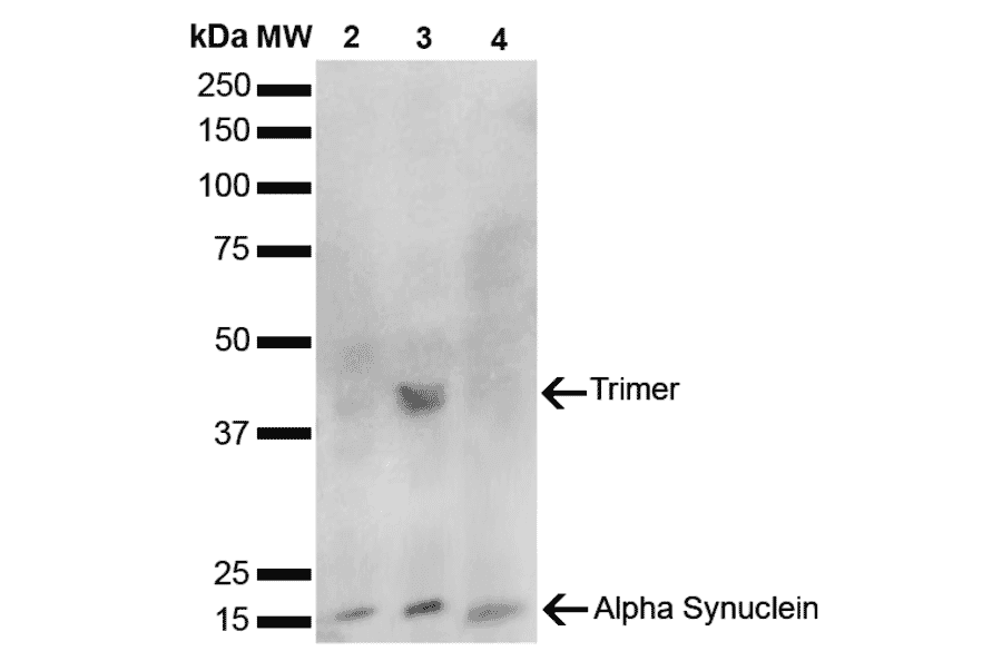 Western Blot - Anti-alpha Synuclein Antibody [10H7] (A304960) - Antibodies.com