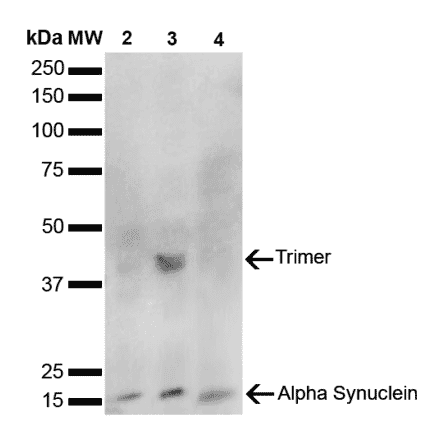 Western Blot - Anti-alpha Synuclein Antibody [10H7] (A304960) - Antibodies.com