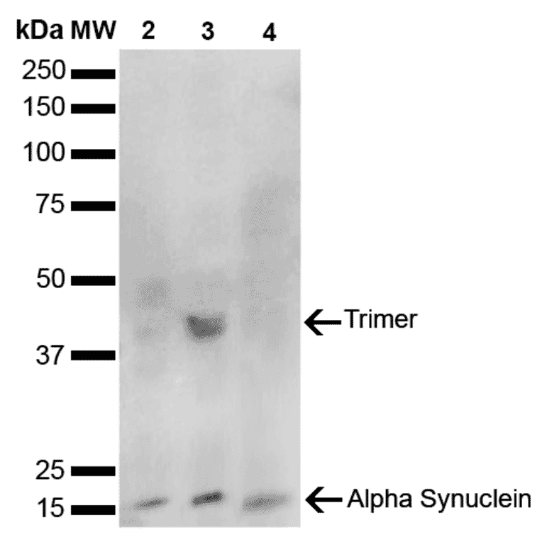 Western Blot - Anti-alpha Synuclein Antibody [10H7] (A304960) - Antibodies.com