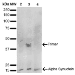 Western Blot - Anti-alpha Synuclein Antibody [10H7] (A304960) - Antibodies.com