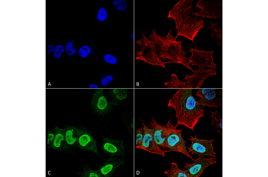 Immunocytochemistry/Immunofluorescence - Anti-alpha Synuclein Antibody [10H7] (A304960) - Antibodies.com