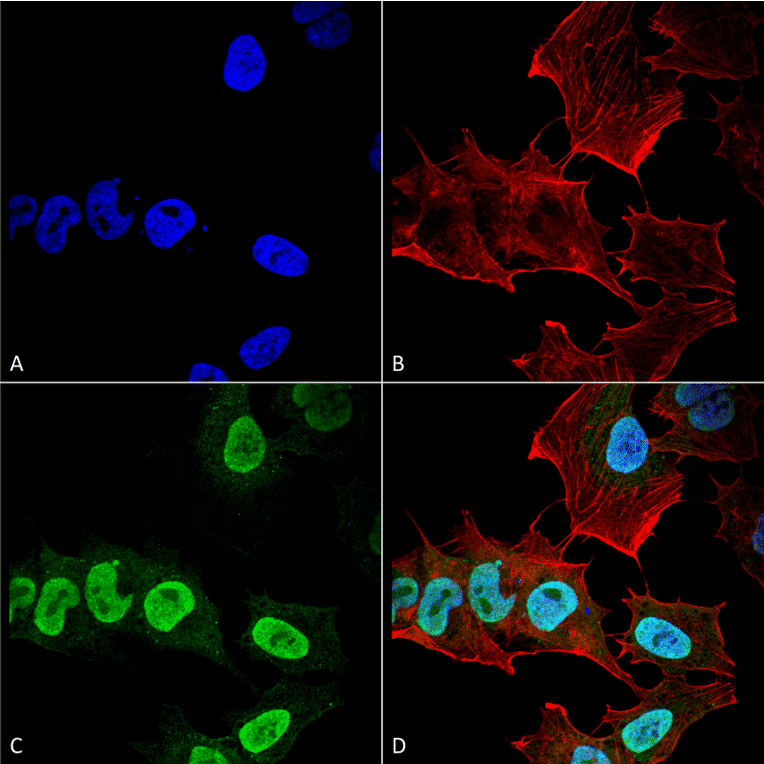 Immunocytochemistry/Immunofluorescence - Anti-alpha Synuclein Antibody [10H7] (A304960) - Antibodies.com