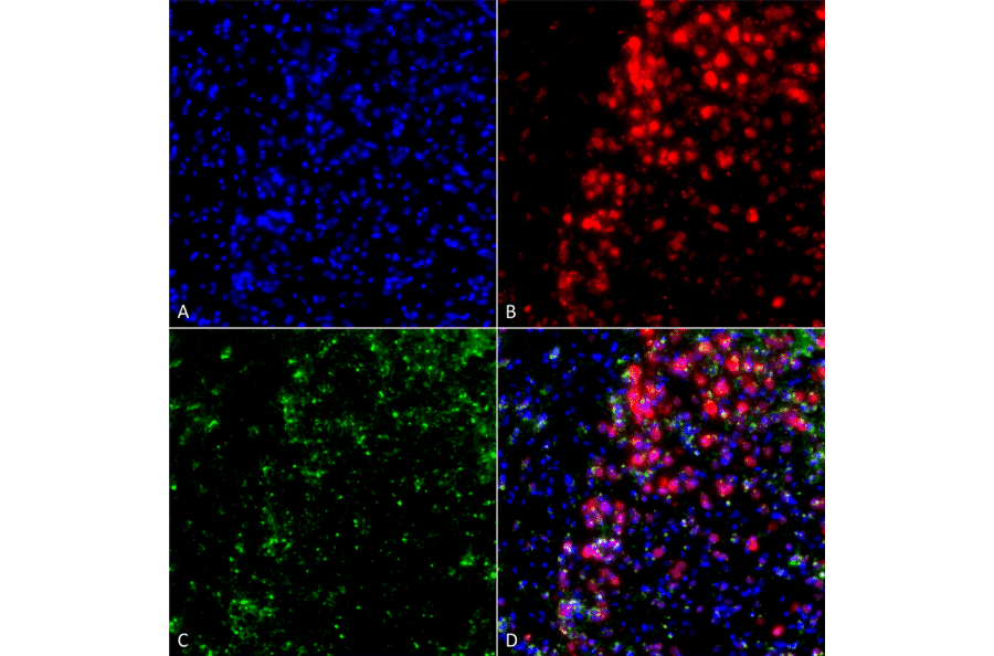 Immunocytochemistry/Immunofluorescence - Anti-alpha Synuclein Antibody [3F8] (A304961) - Antibodies.com