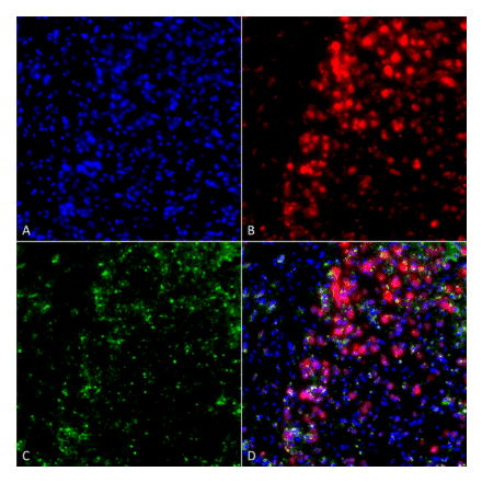 Immunocytochemistry/Immunofluorescence - Anti-alpha Synuclein Antibody [3F8] (A304961) - Antibodies.com