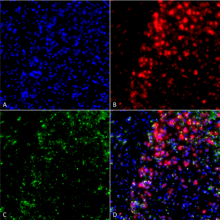 Immunocytochemistry/Immunofluorescence - Anti-alpha Synuclein Antibody [3F8] (A304961) - Antibodies.com