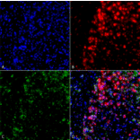 Immunocytochemistry/Immunofluorescence - Anti-alpha Synuclein Antibody [3F8] (A304961) - Antibodies.com