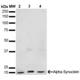 Western Blot - Anti-alpha Synuclein Antibody [3F8] (A304961) - Antibodies.com