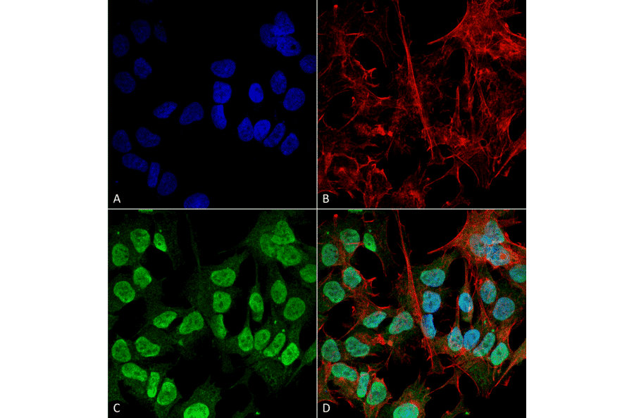 Immunocytochemistry/Immunofluorescence - Anti-alpha Synuclein Antibody [3F8] (A304961) - Antibodies.com