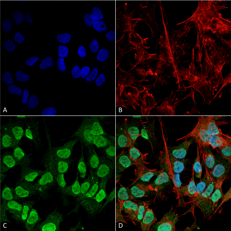 Immunocytochemistry/Immunofluorescence - Anti-alpha Synuclein Antibody [3F8] (A304961) - Antibodies.com