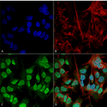 Immunocytochemistry/Immunofluorescence - Anti-alpha Synuclein Antibody [3F8] (A304961) - Antibodies.com