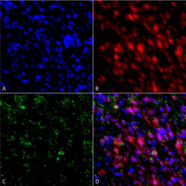 Immunocytochemistry/Immunofluorescence - Anti-alpha Synuclein Antibody [4F1] (A304962) - Antibodies.com