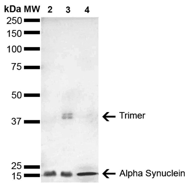 Western Blot - Anti-alpha Synuclein Antibody [4F1] (A304962) - Antibodies.com