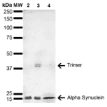 Western Blot - Anti-alpha Synuclein Antibody [4F1] (A304962) - Antibodies.com