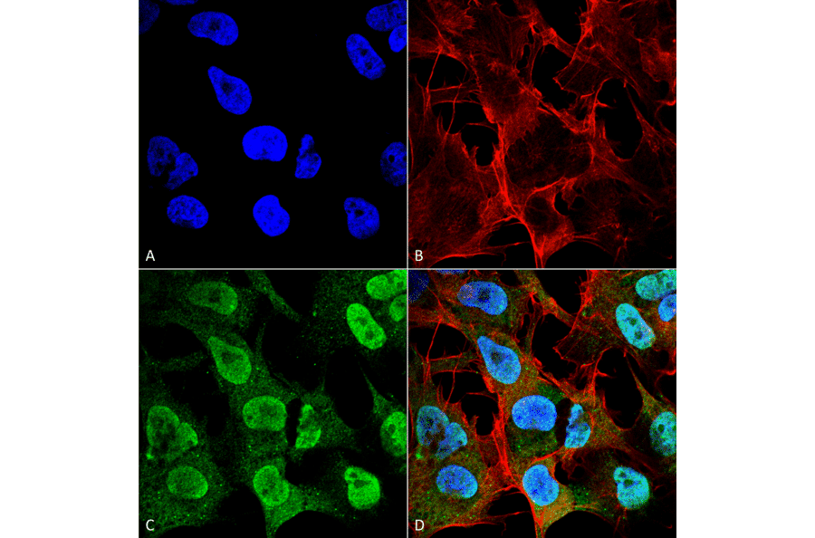 Immunocytochemistry/Immunofluorescence - Anti-alpha Synuclein Antibody [4F1] (A304962) - Antibodies.com