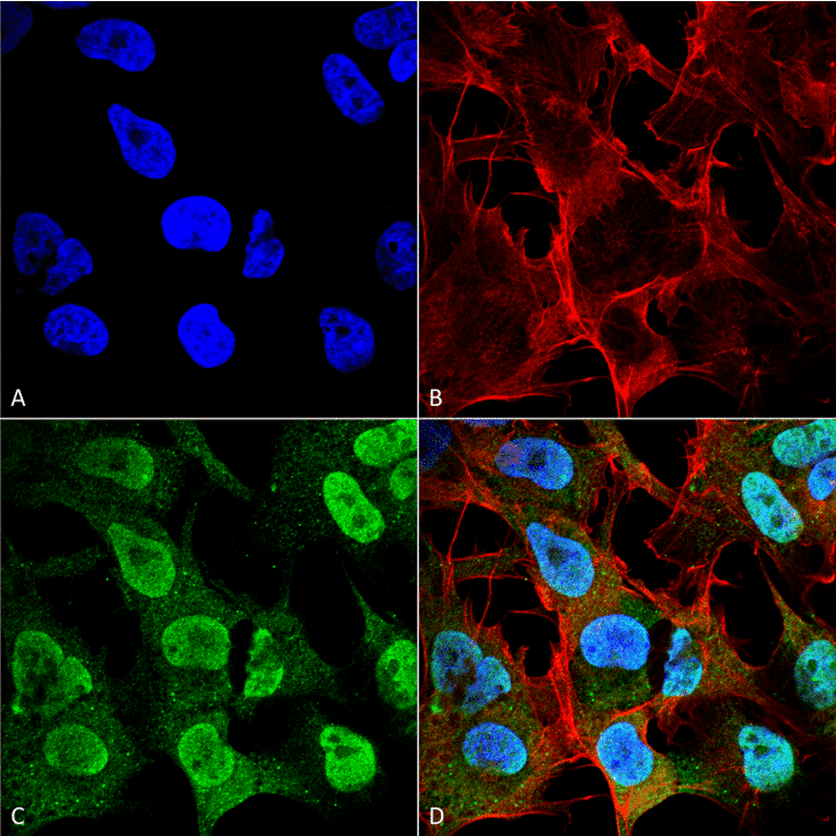 Immunocytochemistry/Immunofluorescence - Anti-alpha Synuclein Antibody [4F1] (A304962) - Antibodies.com