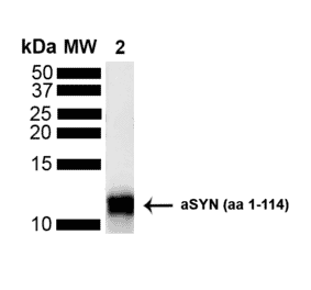 Western Blot - Anti-alpha Synuclein Antibody (A304963) - Antibodies.com