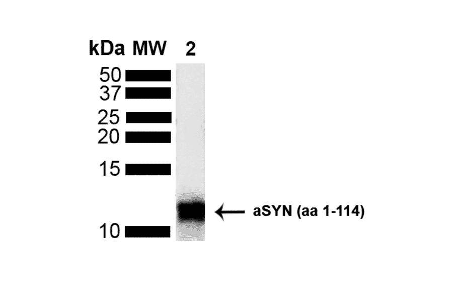 Western Blot - Anti-alpha Synuclein Antibody (A304963) - Antibodies.com